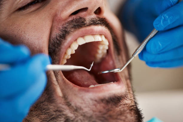 Best Broken Tooth Emergency  in Brookville, OH