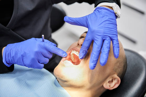 Best Chipped Tooth Repair Near Me  in Brookville, OH